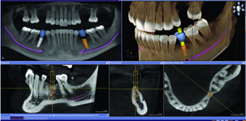xray2